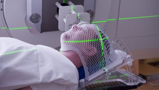 Radioterapia